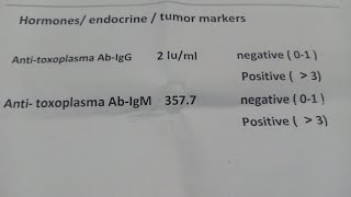 تحليل داء القطط للحامل toxoplasmosis [upl. by Anissej962]