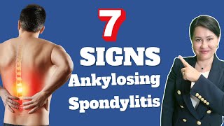 7 Signs of Ankylosing Spondylitis  A Rheumatologist Review [upl. by Valerie]