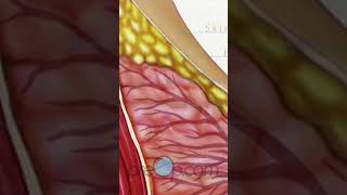 Understanding Incisional Breast Biopsy 🎗️ PreOp BreastHealth Shorts  PreOp® Patient Education 1 [upl. by Anhej]