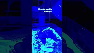 Neonatal jaundice treatment hospital love newborn baby doctor newbornbaby newborndevelopment [upl. by Edmund]