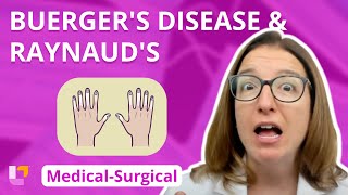 Buergers Disease and Raynauds  MedicalSurgical  Cardiovascular System  LevelUpRN [upl. by Ycniuq]