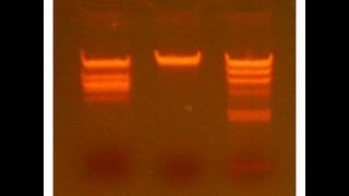 Restriction Digestion  Amrita University [upl. by Vastha995]