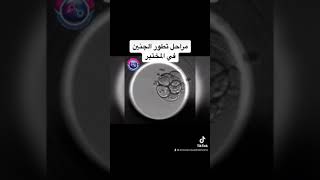 مراحل تطور الجنين في المختبر  ووصول الاجنه لمرحلة Blastoccyst اليوم الخامس [upl. by Leruj]