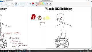 Anaemia The Clinical Picture  Haematinics Deficiencies Part 2  B12 and Folate [upl. by Halona]