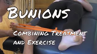 Bunions  Treatment and Exercise [upl. by Ortrud]