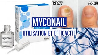 MYCONAIL  CICLOPIROX [upl. by Evonne]