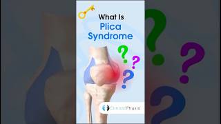 Plica Syndrome physiotherapy physicaltherapy knee kneepain [upl. by Chari]