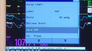 Invasive Pressure Setting up [upl. by Otrepur]