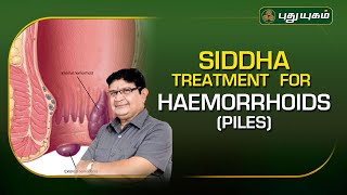 SIDDHA Treatment for HAEMORRHOIDS PILES DrJayaprakash Narayanan  Doctor On Call  PuthuyugamTV [upl. by Aitital]