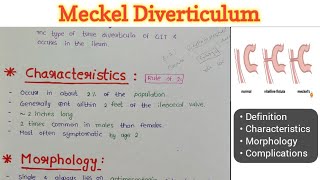 Meckel Diverticulum  GIT Pathology [upl. by Fanning]