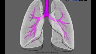 CFD simulation of expanding lungsTotalsim  TotalSim  Experts in CFD [upl. by Lawan]