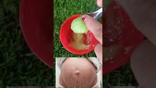 how to remove stretch mark at home best home remedies for stretch marks Priticreation [upl. by Eneirda]