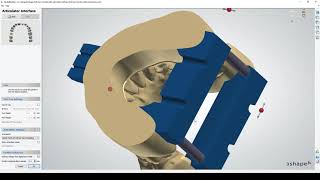 AntiCupping 3Shape Articulator in Model Builder  Formlabs Dental  Form 3B [upl. by Alleroif]