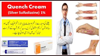 Quench Cream Used For Burns  Quench Cream Uses in Urdu  Silver Sulfadiazine Cream  Burn Treatment [upl. by Isayg544]