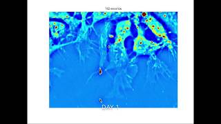 SLIM Neural Stem Cells to Neurons [upl. by Cavan]