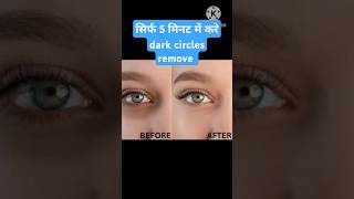 How to remove dark circles in 5 minutes 😱shorts skincare beauty makeup [upl. by Hobbs532]