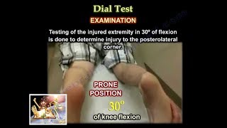 Dial Test  Everything You Need To Know  Dr Nabil [upl. by Llehctim493]