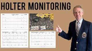 Holter Monitor  Everything you need to know [upl. by Claus]