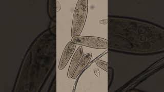 Paramecium Conjugation [upl. by Reisfield201]