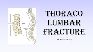 Thoracolumbar fracture  AO classification clinical feature investigation treatment [upl. by Cinnamon]