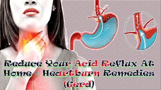 Reduce Your ACID REFLUX At Home Heartburn Remedies GERD  Shorts [upl. by Ainelec440]