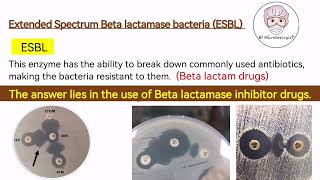 ESBL bacteria Extended Spectrum Betalactamase Bacteria  Antibiotic Resistance English [upl. by Nnayr]