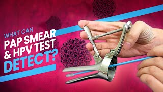 Pap Smear Pap Test and HPV Test  A step by step guide 3D at what happens during the test [upl. by Darooge782]