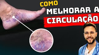 COMO MELHORAR INSTANTANEAMENTE A CIRCULAÇÃO DAS PERNAS E PÉS INCHADOS [upl. by Einnol]