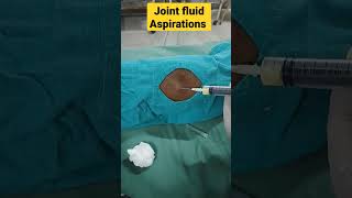 Knee Joint Fluid Aspiration  घुटने से मवाद निकालना  kneesurgery kneepain knee doctor surgeon [upl. by Nwahser]