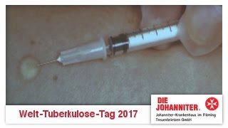 WeltTuberkuloseTag 2017  Johanniter Treuenbrietzen [upl. by Josy]