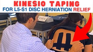 Kinesio Taping for L5S1 Herniated Disc L5S1 Disc Herniation  Dr Marc Dupuis Chiropractor [upl. by Siramad]