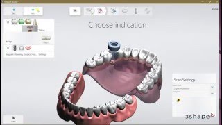 3Shape Implant Studio 2016 Order TRIOS CT Scan Import and Anatomy Design [upl. by Oflodor]