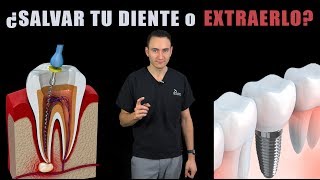 ENDODONCIAS VS IMPLANTES  ¿Es mejor salvar tu diente o extraerlo  Costos 2019 [upl. by Tristam591]