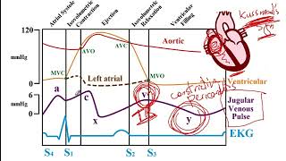 USMLE ACE Video 120 Wigger and FrankStarling Diagram [upl. by Eixid]