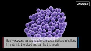 Staph infections can kill March 2019 Vital Signs [upl. by Eciralc]