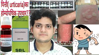 Urticaria Homeopathic medicine for Urticaria explain [upl. by Lletnuahs137]