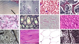 Practice Identifying Connective Tissue Complete [upl. by Nosrak362]