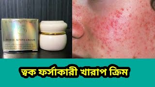 ত্বক ফর্সাকারী খারাপ ক্রিম  gold white active cream honest review [upl. by Kiker]