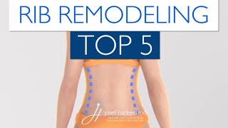 5 Things to Know About Rib Remodeling Surgery [upl. by Vierno583]