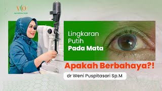 LINGKARAN PUTIH PADA MATA ARCUS SENILIS  VIO OPTICAL CLINIC [upl. by Enohpesrep407]