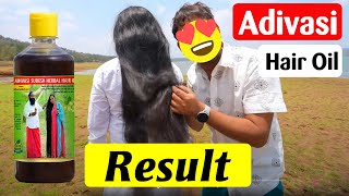 Using Genuine Adivasi Hair Oil and Got SHOCKING Results [upl. by Marquez111]