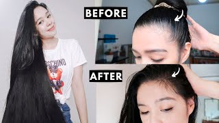 How I Grew Back My Hairline amp Prevent Receding Hairline [upl. by Dodie]