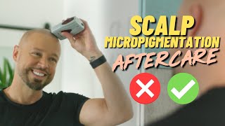 Scalp Micropigmentation AFTERCARE Guidelines [upl. by Valaria]