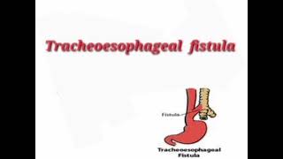 Tracheoesophageal fistula mrcpch Communication [upl. by Nytnerb]