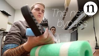 The nerve bypass how to move a paralysed hand [upl. by Oivlis]