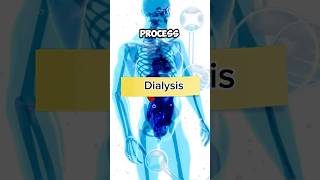 Dialysis procedure  types of dialysis  what is dialysis dialysis dialysislife dialysispatient [upl. by Adlin601]