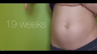 19 Weeks Pregnant  Food Troubles 7lbs Anatomy Scan BAD SKIN [upl. by Allyson752]