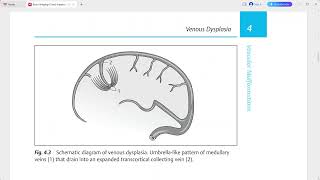 BRAIN DIRECT DIAGNOSIS [upl. by Theobald781]