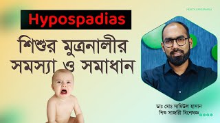 বাচ্চাদের মুত্রনালীর সমস্যা। Hypospadias  Symptoms Diagnosis amp Treatment [upl. by Wrigley]