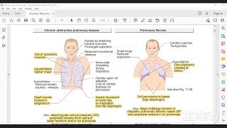 Respiratory medicine Part 1  davidson based [upl. by Jodie]